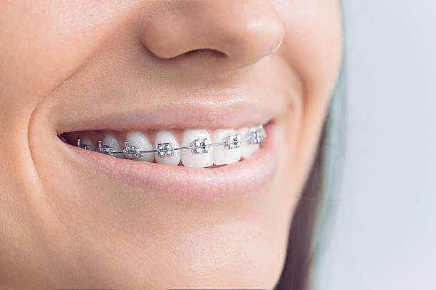 Best Invisalign and Clear Aligners  in Broadview Heights, OH